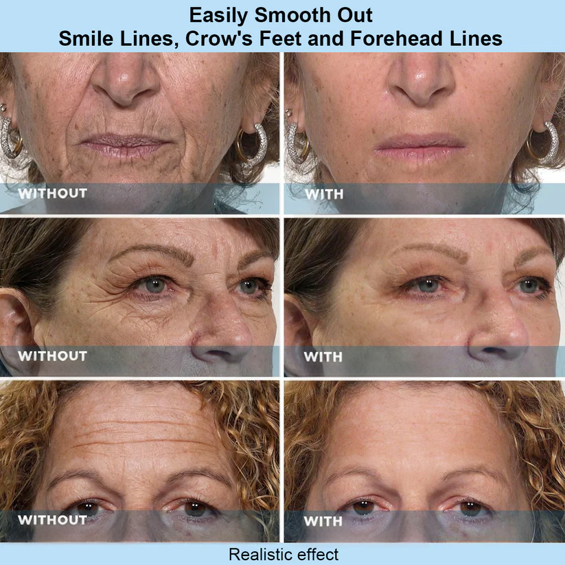 Rootburst® Temporary Face Tightening Serum