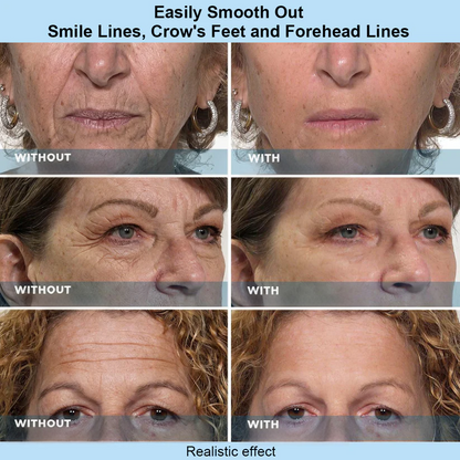 Rootburst® Temporary Face Tightening Serum
